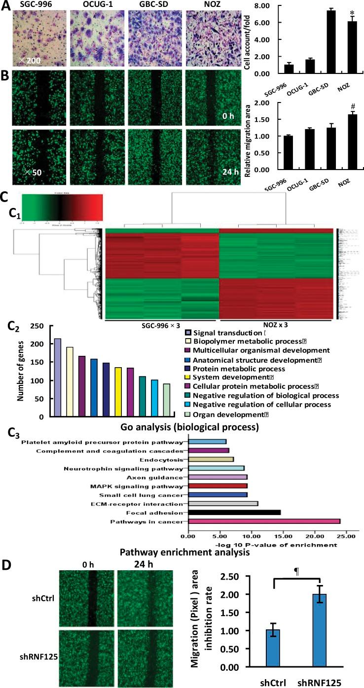 https://cdn.ncbi.nlm.nih.gov/pmc/blobs/342f/5564816/ae26cb2ecc21/oncotarget-08-49897-g002.jpg