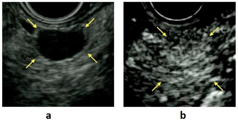 https://cdn.ncbi.nlm.nih.gov/pmc/blobs/3432/7919683/47b2db864b4f/diagnostics-11-00316-g001.jpg