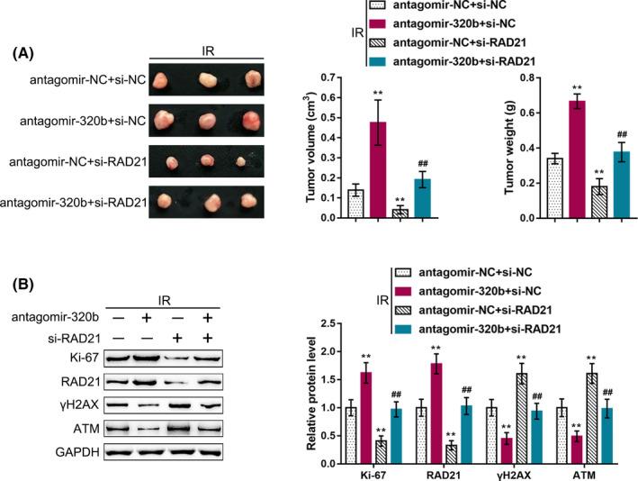 https://cdn.ncbi.nlm.nih.gov/pmc/blobs/3433/7894001/1a5d57476ea9/CAS-112-575-g006.jpg