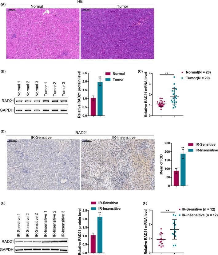 https://cdn.ncbi.nlm.nih.gov/pmc/blobs/3433/7894001/e1c745d49169/CAS-112-575-g001.jpg