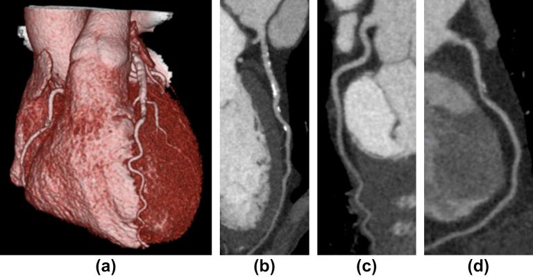 https://cdn.ncbi.nlm.nih.gov/pmc/blobs/3434/3807656/0a4000778bd7/gr4.jpg