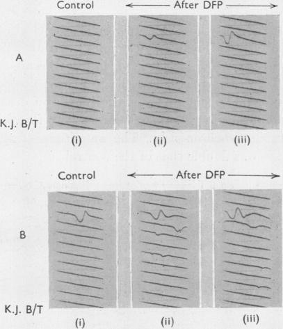https://cdn.ncbi.nlm.nih.gov/pmc/blobs/3435/1392086/5d527eba4aba/jphysiol01455-0122-a.jpg