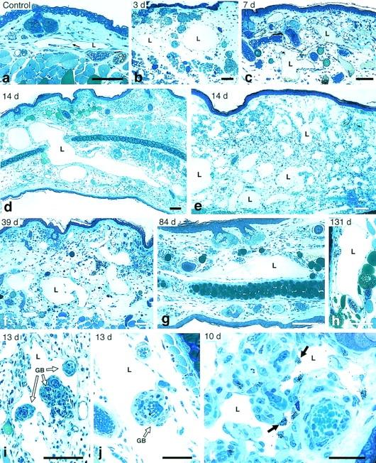 https://cdn.ncbi.nlm.nih.gov/pmc/blobs/3438/2194262/afb3b52d370c/20021244f1.jpg