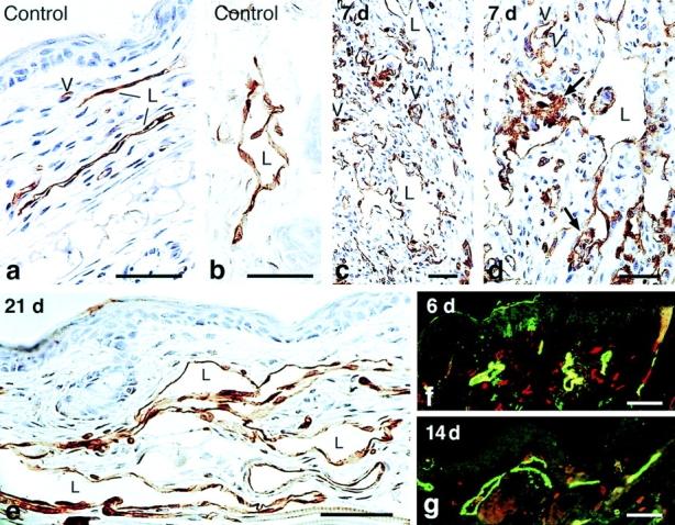 https://cdn.ncbi.nlm.nih.gov/pmc/blobs/3438/2194262/fc95037f75e3/20021244f3.jpg