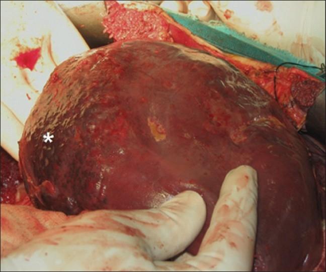 https://cdn.ncbi.nlm.nih.gov/pmc/blobs/343b/3016500/ac512aff7433/SJG-16-116-g004.jpg