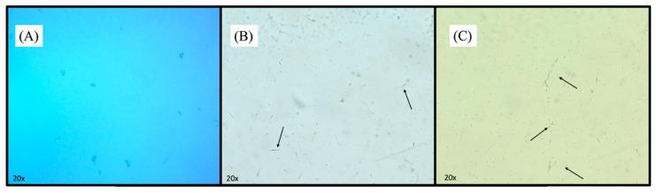 https://cdn.ncbi.nlm.nih.gov/pmc/blobs/343c/11728454/9fa3c6d32f90/pharmaceutics-16-01524-g002.jpg