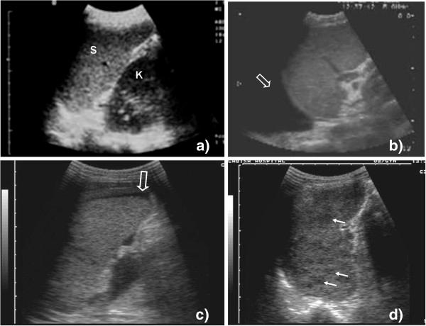 https://cdn.ncbi.nlm.nih.gov/pmc/blobs/3442/3554543/40647cdd81fb/2036-7902-4-21-5.jpg