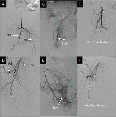 https://cdn.ncbi.nlm.nih.gov/pmc/blobs/3446/8191329/6c918ae1eae7/TJOG-18-163-g1.jpg