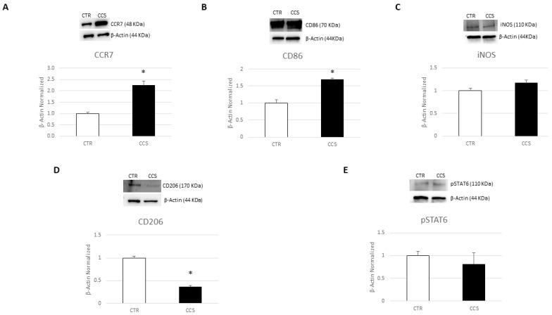 https://cdn.ncbi.nlm.nih.gov/pmc/blobs/344e/10886672/ce5c4b8e5d99/cancers-16-00714-g001.jpg