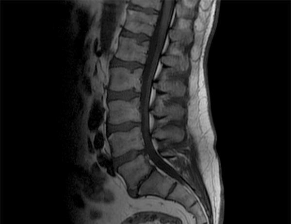 https://cdn.ncbi.nlm.nih.gov/pmc/blobs/3450/4170840/799491001960/medscimonit-20-1634-g001.jpg
