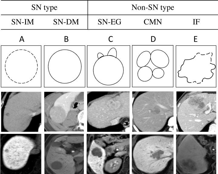 https://cdn.ncbi.nlm.nih.gov/pmc/blobs/3450/5444699/21ff3b7afe2e/oncotarget-08-29741-g004.jpg
