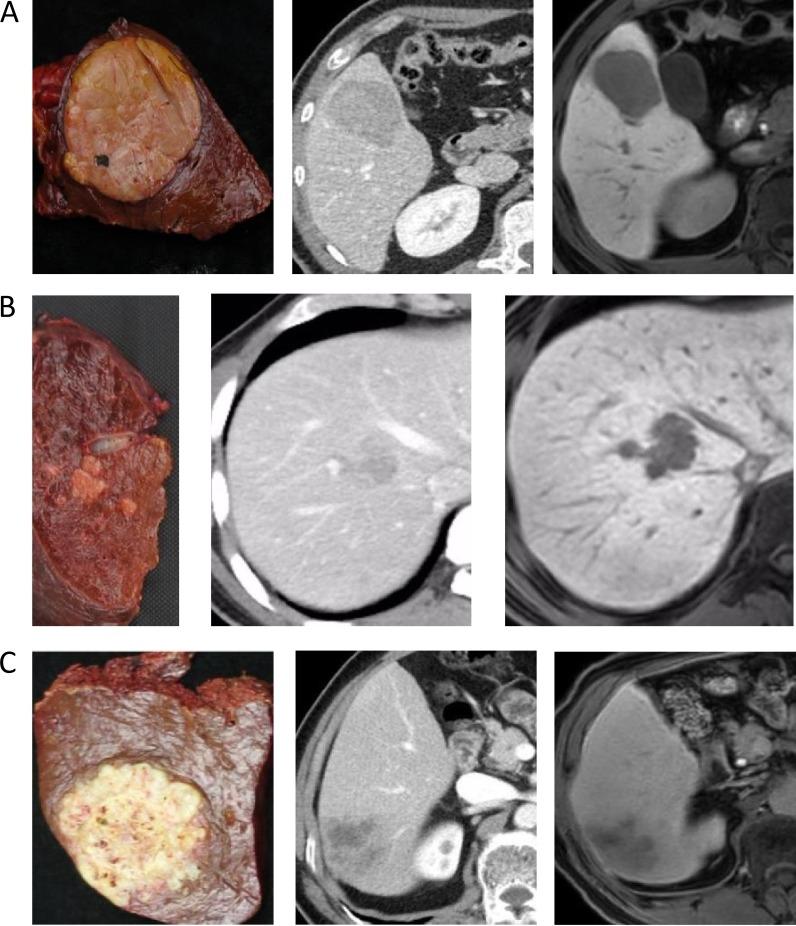 https://cdn.ncbi.nlm.nih.gov/pmc/blobs/3450/5444699/e106f9ab98cc/oncotarget-08-29741-g002.jpg