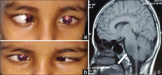 https://cdn.ncbi.nlm.nih.gov/pmc/blobs/3452/9114572/887def0bce88/IJO-70-952-g001.jpg