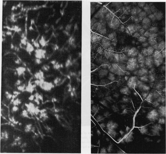 https://cdn.ncbi.nlm.nih.gov/pmc/blobs/345f/1214785/234eaf1ca45a/brjopthal00268-0093-a.jpg