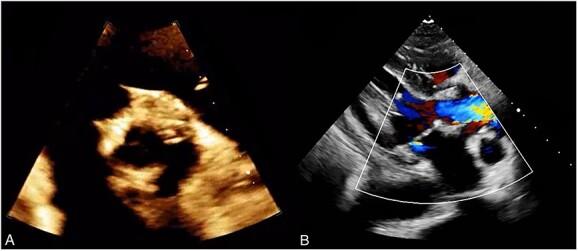 https://cdn.ncbi.nlm.nih.gov/pmc/blobs/3460/10271217/5193be8691d5/rjad299f3.jpg