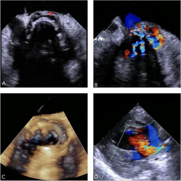 https://cdn.ncbi.nlm.nih.gov/pmc/blobs/3460/10271217/a7d508d6c294/rjad299f1.jpg
