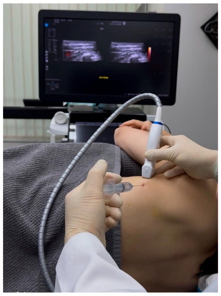 https://cdn.ncbi.nlm.nih.gov/pmc/blobs/3475/12346195/e6556fdee1aa/diagnostics-15-01891-g004.jpg