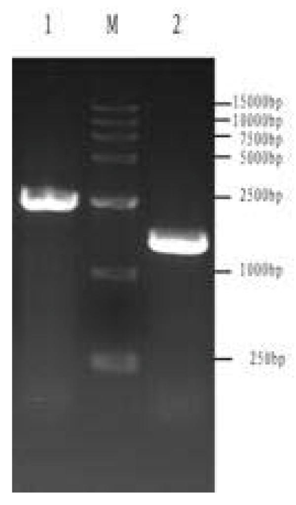https://cdn.ncbi.nlm.nih.gov/pmc/blobs/3479/2867803/6783a7c6cfdc/1743-422X-7-83-2.jpg