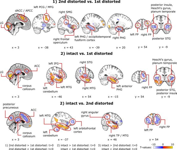 https://cdn.ncbi.nlm.nih.gov/pmc/blobs/3480/5607552/db003222eaa6/BRB3-7-e00789-g004.jpg