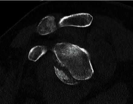 https://cdn.ncbi.nlm.nih.gov/pmc/blobs/3482/7443034/cf0912cf46e9/CRIOR2020-8826803.001.jpg