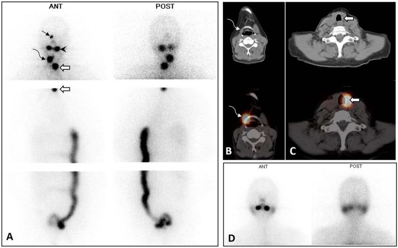 https://cdn.ncbi.nlm.nih.gov/pmc/blobs/3484/7527547/05bb39106075/CPD-26-3812_F3.jpg