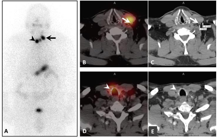 https://cdn.ncbi.nlm.nih.gov/pmc/blobs/3484/7527547/40b8c9f172ed/CPD-26-3812_F5.jpg