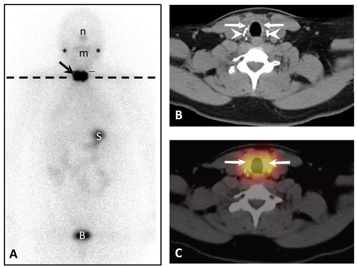 https://cdn.ncbi.nlm.nih.gov/pmc/blobs/3484/7527547/8116a9b6a2da/CPD-26-3812_F4.jpg