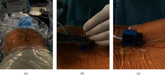 https://cdn.ncbi.nlm.nih.gov/pmc/blobs/3488/9444441/98c169fb6478/BMRI2022-8419739.003.jpg