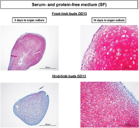 https://cdn.ncbi.nlm.nih.gov/pmc/blobs/348f/9392980/5e110ecfe7e7/BJBMS-22-560-g005.jpg