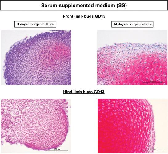 https://cdn.ncbi.nlm.nih.gov/pmc/blobs/348f/9392980/bd8d8d337774/BJBMS-22-560-g003.jpg