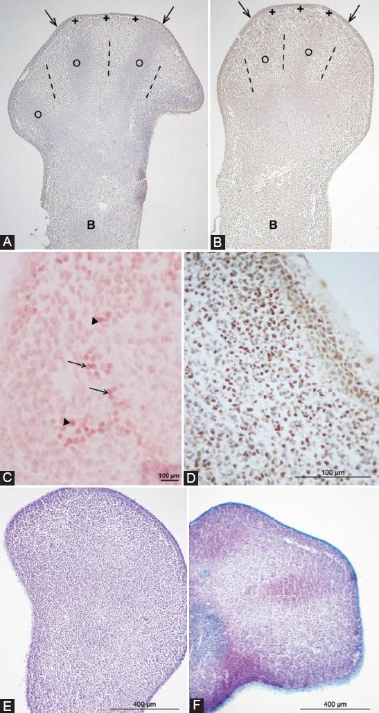 https://cdn.ncbi.nlm.nih.gov/pmc/blobs/348f/9392980/df2f324a1ed4/BJBMS-22-560-g001.jpg