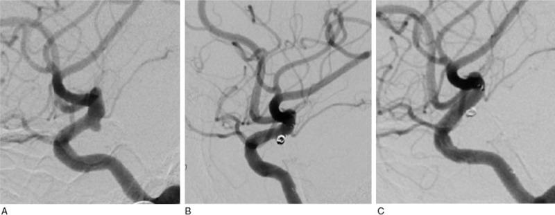 https://cdn.ncbi.nlm.nih.gov/pmc/blobs/3492/5604621/7ea8ea7eb1b6/medi-96-e7457-g006.jpg