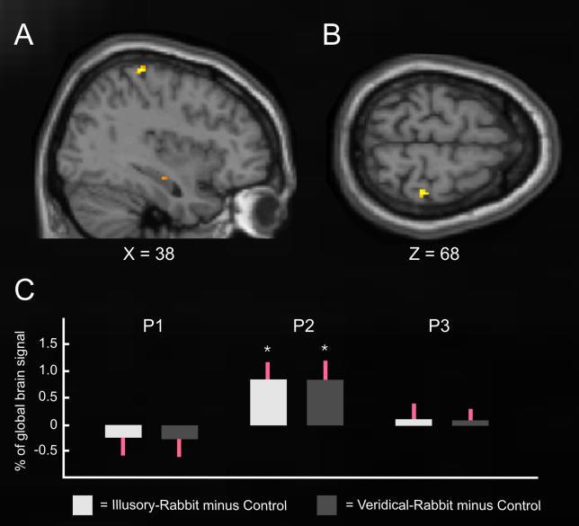 https://cdn.ncbi.nlm.nih.gov/pmc/blobs/3495/1397895/3a0a63feaff8/pbio.0040069.g004.jpg