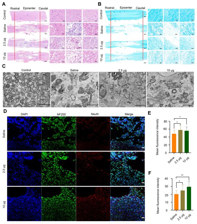 https://cdn.ncbi.nlm.nih.gov/pmc/blobs/3495/7754097/bb7f61df3ee2/IJN-15-10113-g0005.jpg