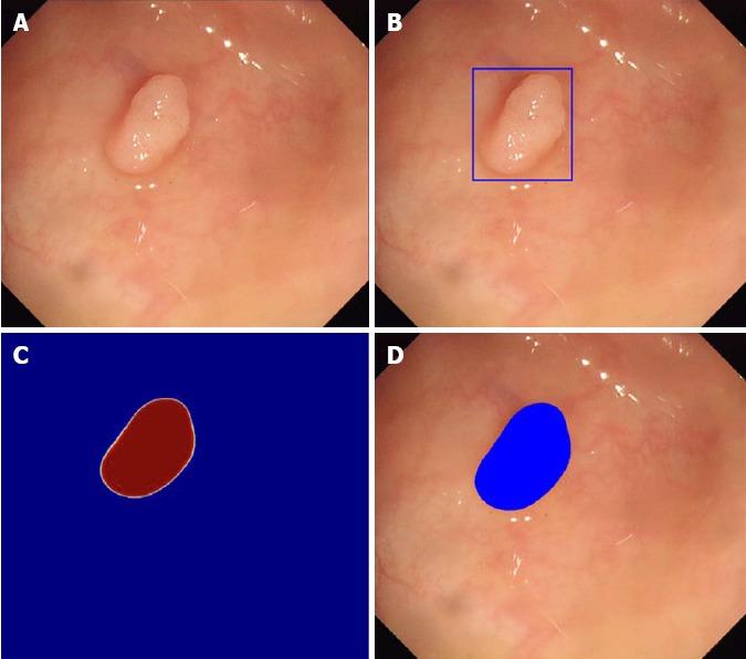 https://cdn.ncbi.nlm.nih.gov/pmc/blobs/3496/6198310/582187ef1c27/WJGE-10-239-g001.jpg