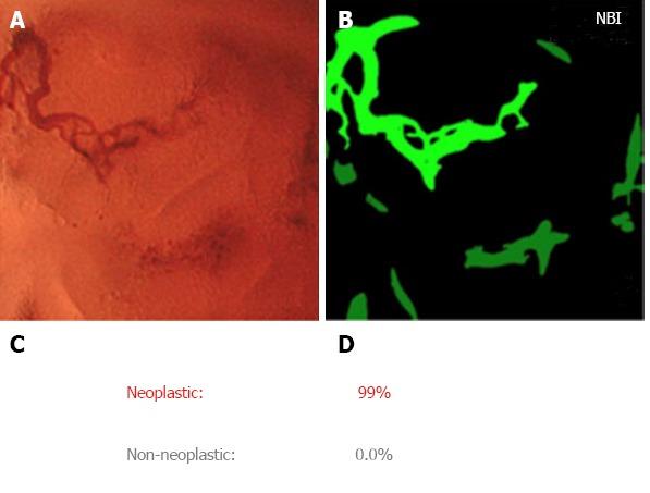 https://cdn.ncbi.nlm.nih.gov/pmc/blobs/3496/6198310/e5bb76cfe32a/WJGE-10-239-g002.jpg