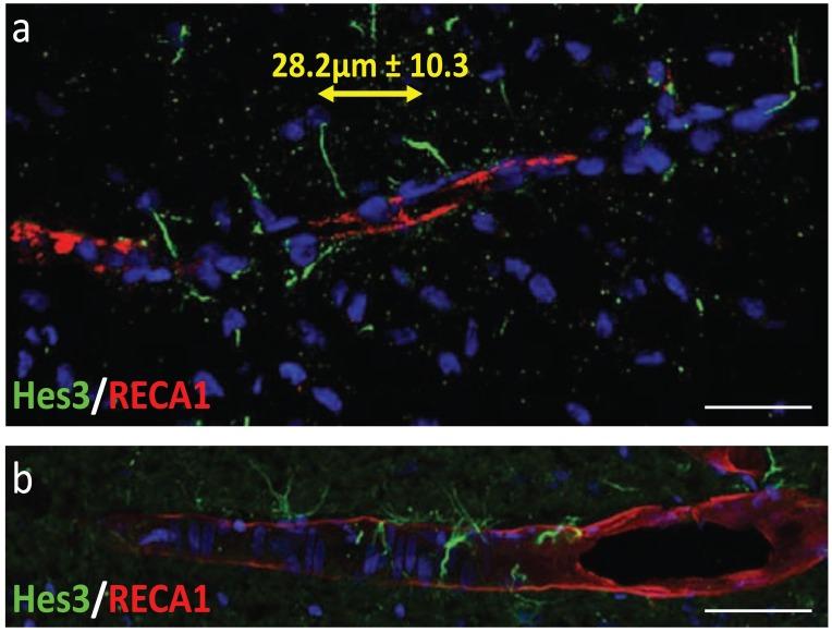 https://cdn.ncbi.nlm.nih.gov/pmc/blobs/349a/3580829/32e001ce8e91/CDTCNSND-11-805_F5.jpg
