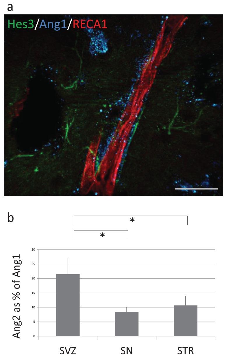 https://cdn.ncbi.nlm.nih.gov/pmc/blobs/349a/3580829/5de3884c4901/CDTCNSND-11-805_F4.jpg