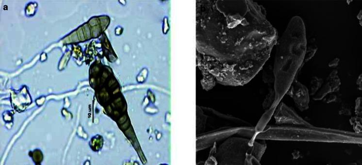 https://cdn.ncbi.nlm.nih.gov/pmc/blobs/349c/4473279/e2caffedbb83/11356_2014_4070_Fig2_HTML.jpg