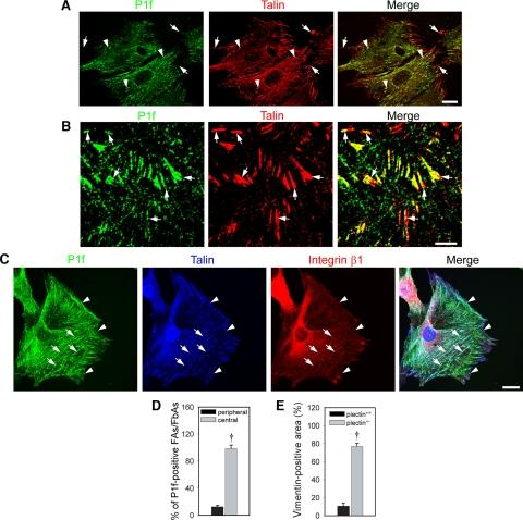 https://cdn.ncbi.nlm.nih.gov/pmc/blobs/34a0/2947472/e4413a65437b/zmk0191095950001.jpg