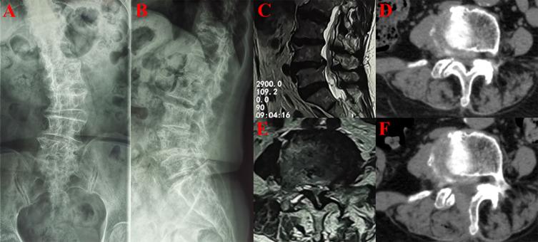 https://cdn.ncbi.nlm.nih.gov/pmc/blobs/34a1/10257922/ebcb3359a1da/CIA-18-911-g0004.jpg