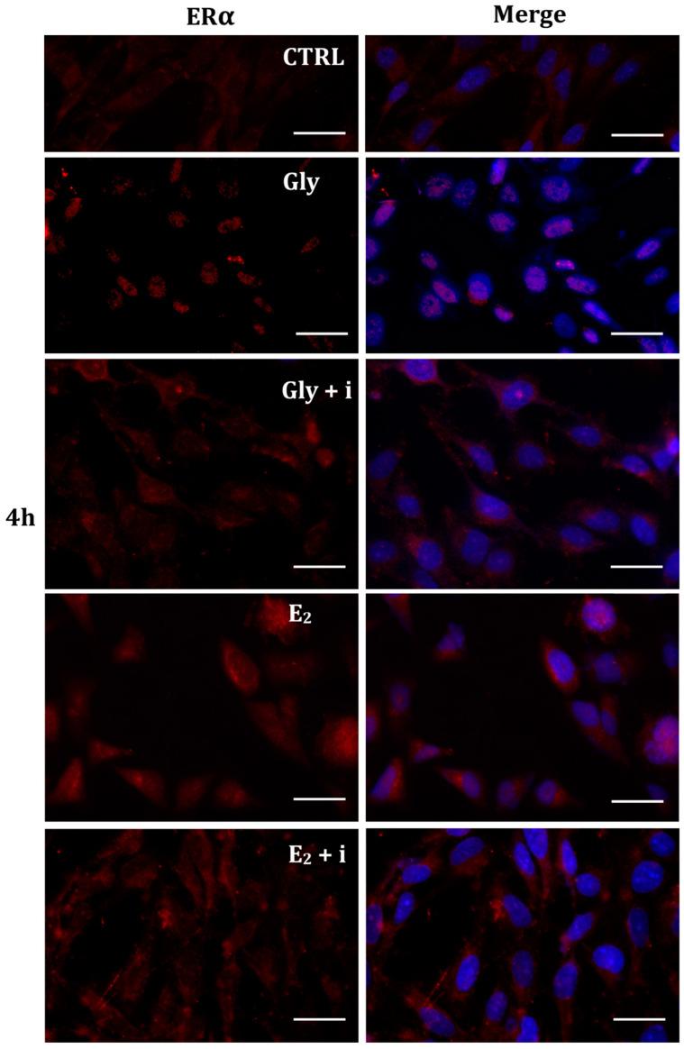 https://cdn.ncbi.nlm.nih.gov/pmc/blobs/34a1/11241661/75eef0d0f18d/ijms-25-07039-g007.jpg