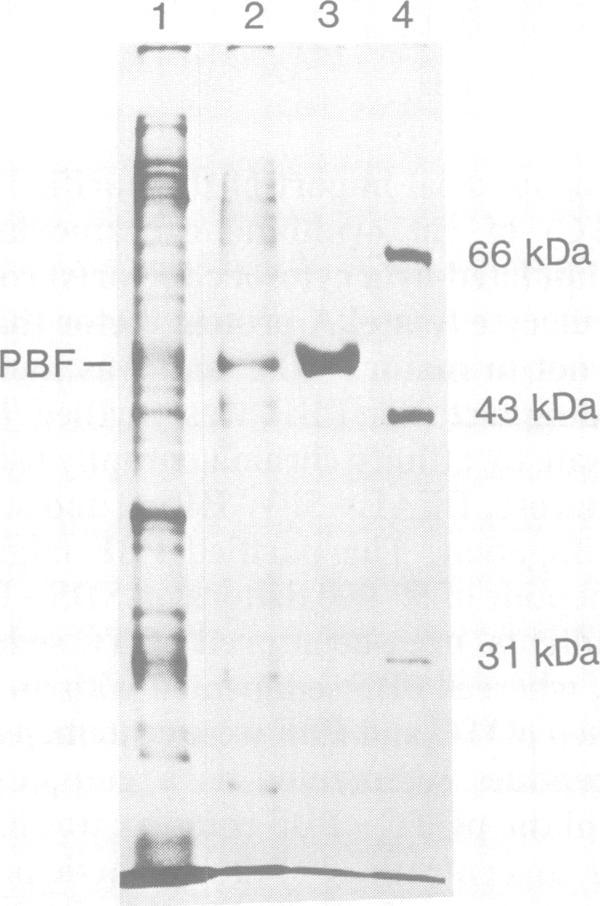https://cdn.ncbi.nlm.nih.gov/pmc/blobs/34a8/552050/7d5e0d11de59/emboj00237-0179-a.jpg