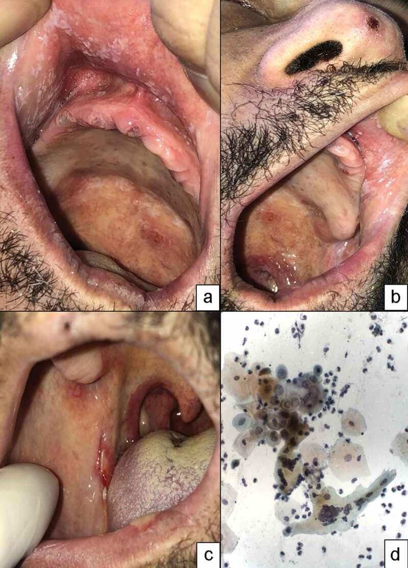 https://cdn.ncbi.nlm.nih.gov/pmc/blobs/34a8/8920376/ce4812557422/ZJOM_A_2047491_F0001_OC.jpg