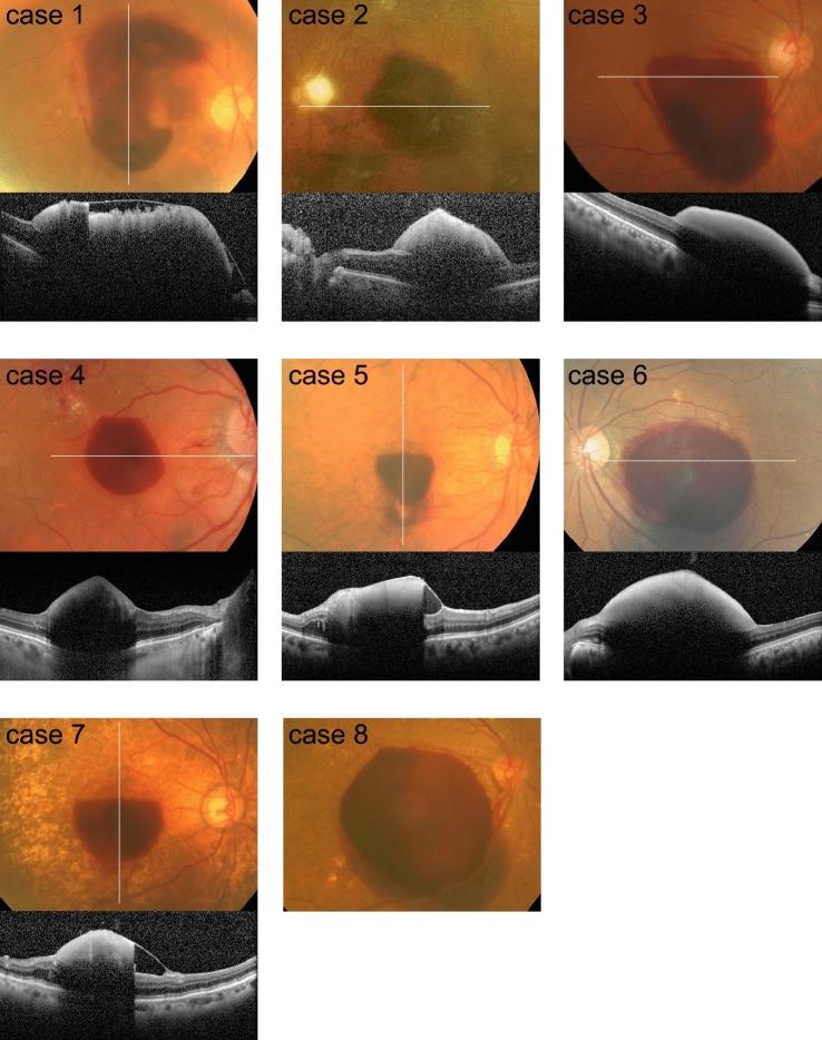 https://cdn.ncbi.nlm.nih.gov/pmc/blobs/34a8/9523073/8763be204dce/41598_2022_20949_Fig1_HTML.jpg