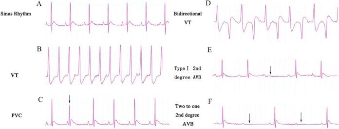https://cdn.ncbi.nlm.nih.gov/pmc/blobs/34ab/6304267/7ed82e35c259/peerj-06-6110-g002.jpg