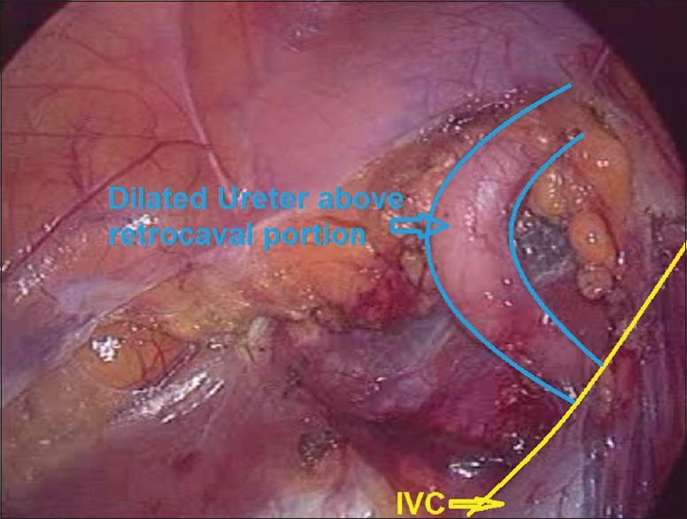 https://cdn.ncbi.nlm.nih.gov/pmc/blobs/34ae/5656955/9f0caf588342/UA-9-324-g002.jpg