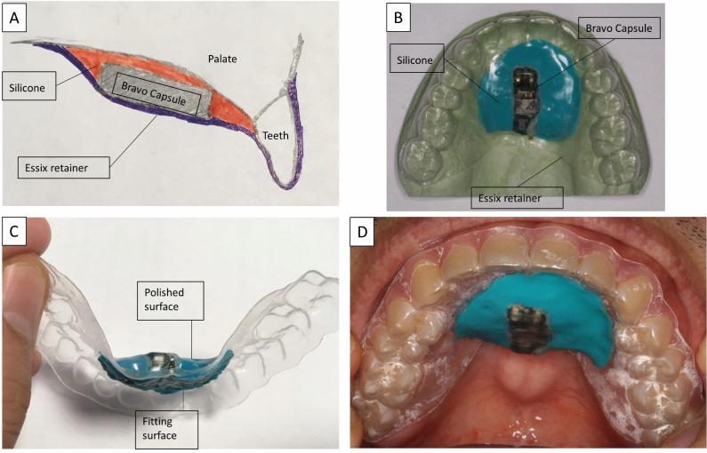 https://cdn.ncbi.nlm.nih.gov/pmc/blobs/34b0/11291917/17ab321a38d6/41598_2024_68748_Fig1_HTML.jpg