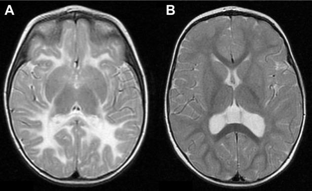 https://cdn.ncbi.nlm.nih.gov/pmc/blobs/34b1/4116383/1957ab94bc34/jcnsd-6-2014-059f2.jpg