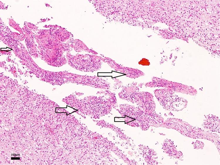 https://cdn.ncbi.nlm.nih.gov/pmc/blobs/34b1/4116383/ecf33eeab7ef/jcnsd-6-2014-059f5.jpg